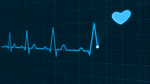 image de l'article Jouez au Docteur House avec le serious game: electrocardiogramme Agile